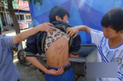 ​北京奶西村围殴少年纪变处置截止:30小时后被抓_父母糟心