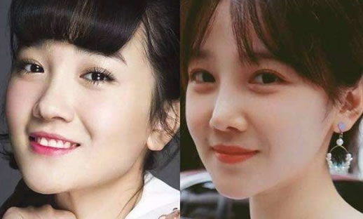 陈小纭年龄多大了曝光:陈小纭整容前后照片对比