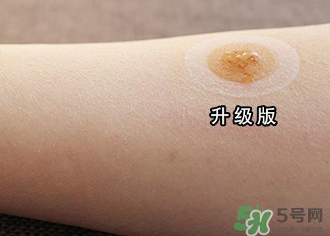 艾灸贴后有水泡怎么办?贴艾灸贴应注意些什么? 艾灸贴后有水泡怎么办?贴艾灸贴应注意些什么?