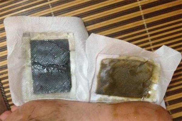 老北京足贴能减肥吗 老北京足贴能贴肚脐吗 老北京足贴能减肥吗 老北京足贴能贴肚脐吗