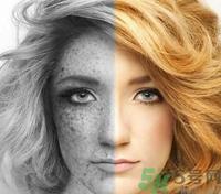 晒斑怎么形成的?晒斑怎么去除? 晒斑怎么形成的?晒斑怎么去除?