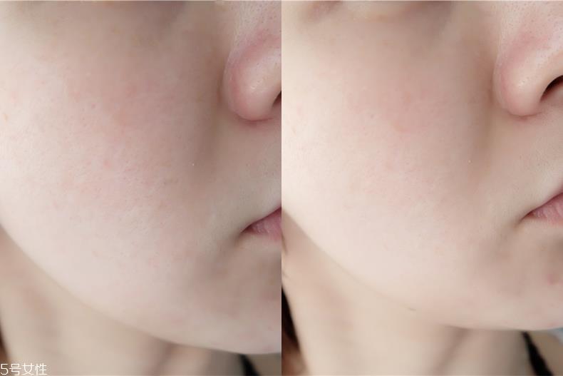 台塑生医产品不合格吗 很安心的医美级面膜 台塑生医产品不合格吗 很安心的医美级面膜