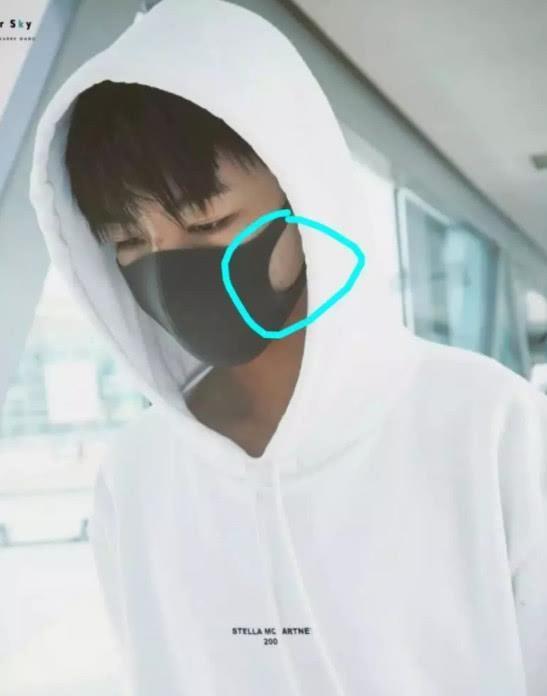 王俊凯近照曝光,脸上爆痘,身上多处擦伤,网友得知原因:心疼!