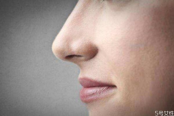 如何收缩鼻翼 收缩鼻翼的办法 如何收缩鼻翼 收缩鼻翼的办法