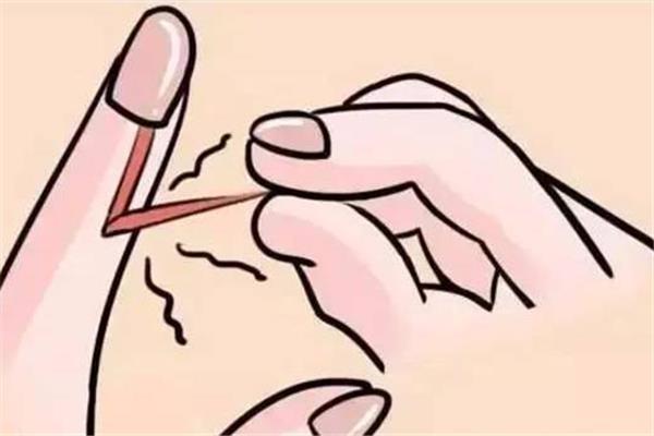 手长倒刺是什么原因造成的 手长倒刺是缺少什么维生素 手长倒刺是什么原因造成的 手长倒刺是缺少什么维生素