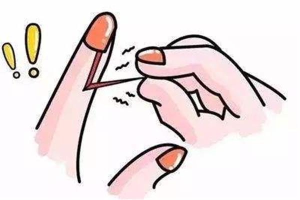 手长倒刺是什么原因造成的 手长倒刺是缺少什么维生素 手长倒刺是什么原因造成的 手长倒刺是缺少什么维生素