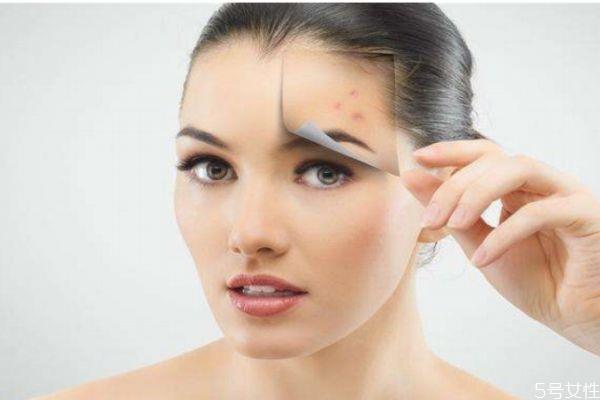 为什么刚长好地方又出现痘痘呢 痘痘为什么会反复呢 为什么刚长好地方又出现痘痘呢 痘痘为什么会反复呢