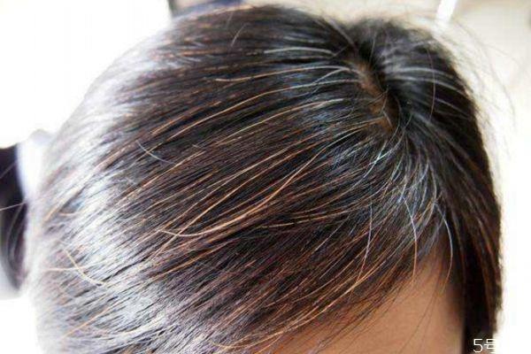 如何减少白头发 减少白头发的方法有什么 如何减少白头发 减少白头发的方法有什么