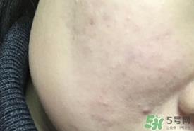 kate粉底液怎么样?kate粉底液好用吗? kate粉底液怎么样?kate粉底液好用吗?