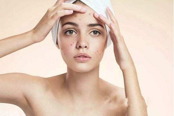 芙清凝胶有什么功效 芙清凝胶适合什么人 芙清凝胶有什么功效 芙清凝胶适合什么人