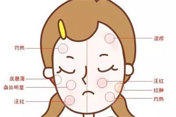 敏感肌可以用芦荟胶吗 敏感肌适合什么成分的护肤品