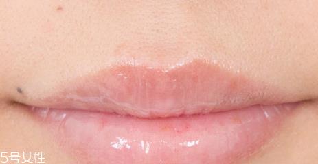 兰芝唇膜吃进去怎么办?拥有水嫩嘴唇 兰芝唇膜吃进去怎么办?拥有水嫩嘴唇