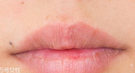 兰芝唇膜吃进去怎么办?拥有水嫩嘴唇 兰芝唇膜吃进去怎么办?拥有水嫩嘴唇