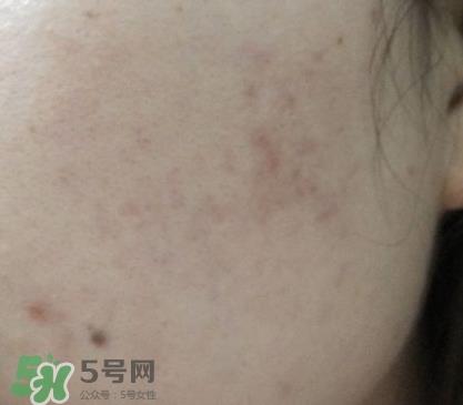 屈臣氏白金系列有问题_曝光