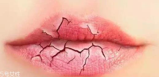 唇纹深适合什么口红?别用哑光口红 唇纹深适合什么口红?别用哑光口红
