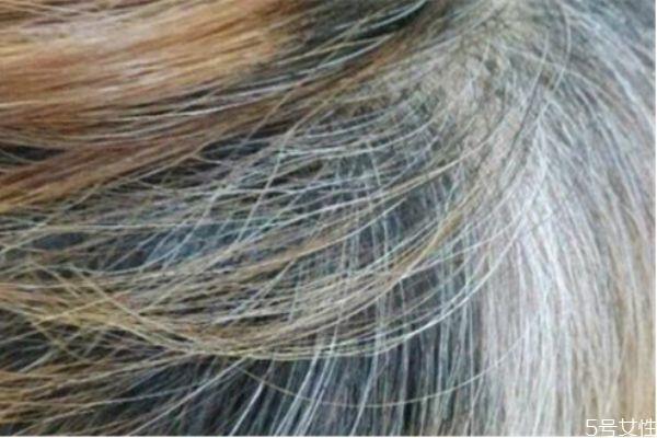 染发第二天洗有影响吗 第一天染发第二天可以洗吗 染发第二天洗有影响吗 第一天染发第二天可以洗吗