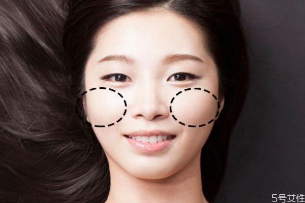 什么是苹果肌呢 苹果肌有什么作用呢 什么是苹果肌呢 苹果肌有什么作用呢