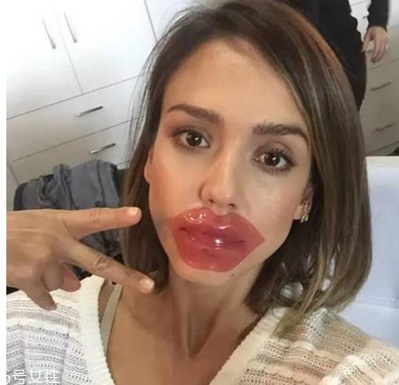 怎么使用唇膜更好发挥作用?敷完唇膜后需要护理 怎么使用唇膜更好发挥作用?敷完唇膜后需要护理