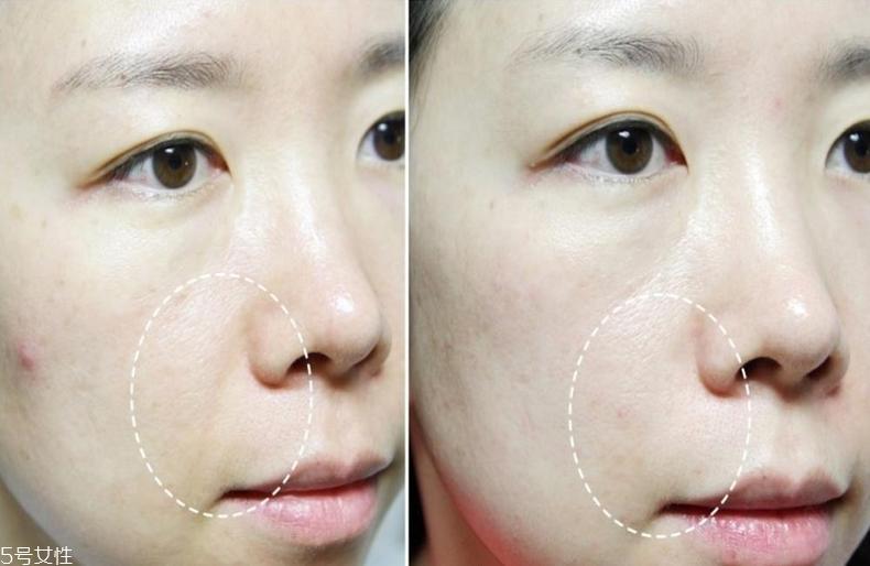 莱珀妮鱼子紧颜液适合什么人 LP蓝鱼子精华推荐肤质