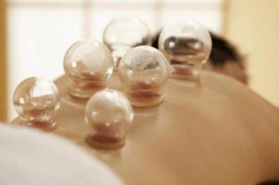 ​拔火罐能去湿气吗 拔火罐起水泡是怎么回事