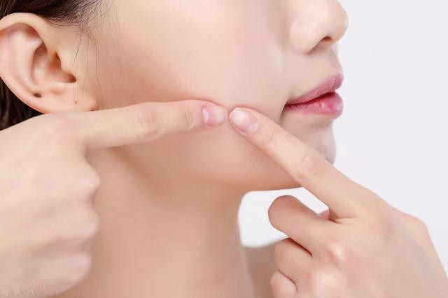 怎样用牙膏才可以祛痘（想要祛痘做好这四点）(5)