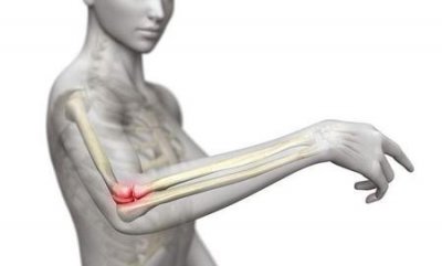 ​打网球如何避免得网球肘(如何预防网球肘发生)