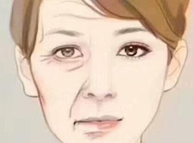 ​女人脸上法令纹是怎样形成的(法令我应怎样去消除)