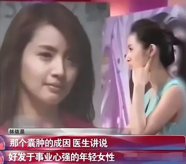 林依晨宣布订婚男方身价过亿（豪门梦碎林依晨）(27)