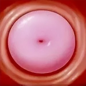 ​被医生肯定的“好宫颈”，原来长这样！