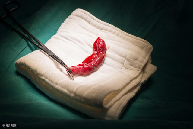 吴彦祖谈阑尾破裂原因(差点要了吴彦祖命的阑尾炎)(3)