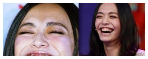 女星好不好看,咧嘴一笑就知道了,郑爽真的好可爱啊!