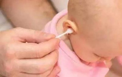 ​宝宝耳屎怎么清理(十个月宝宝耳屎怎么清理)