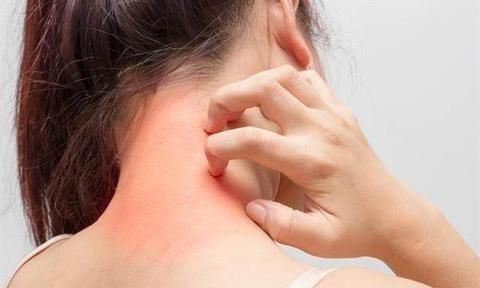 发物的食物有哪些,发性的食物有哪些?图4