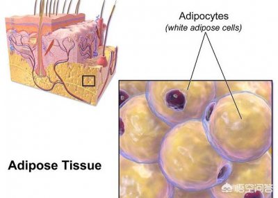 ​抽脂减肥管用吗(抽脂减肥有什么副作用)